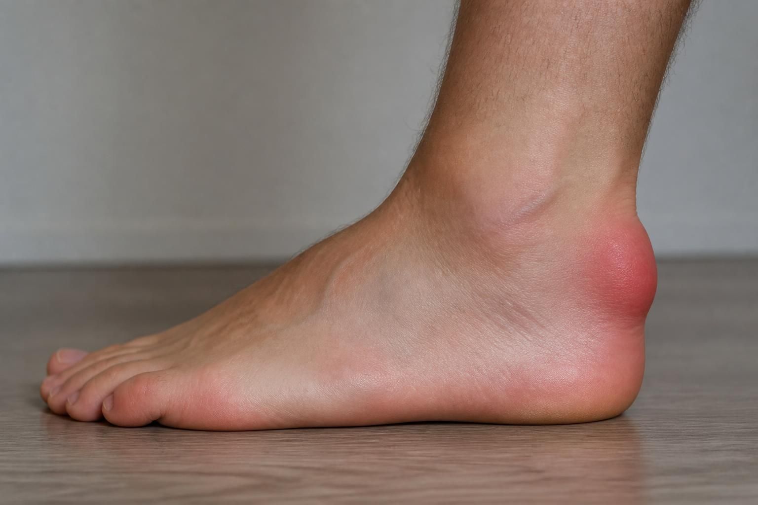 découvrez les symptômes de la bursite au talon à ne pas ignorer pour une prise en charge rapide et efficace. apprenez à reconnaître les signes d'alerte et à prévenir cette inflammation douloureuse.